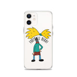 Football Head iPhone Case