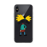 Football Head iPhone Case