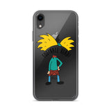 Football Head iPhone Case